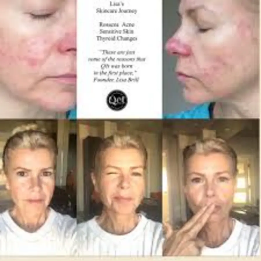 Before and after photos: Colorescience mineral sunscreen clinical results—enhanced radiance, even skin tone, and sun protection.