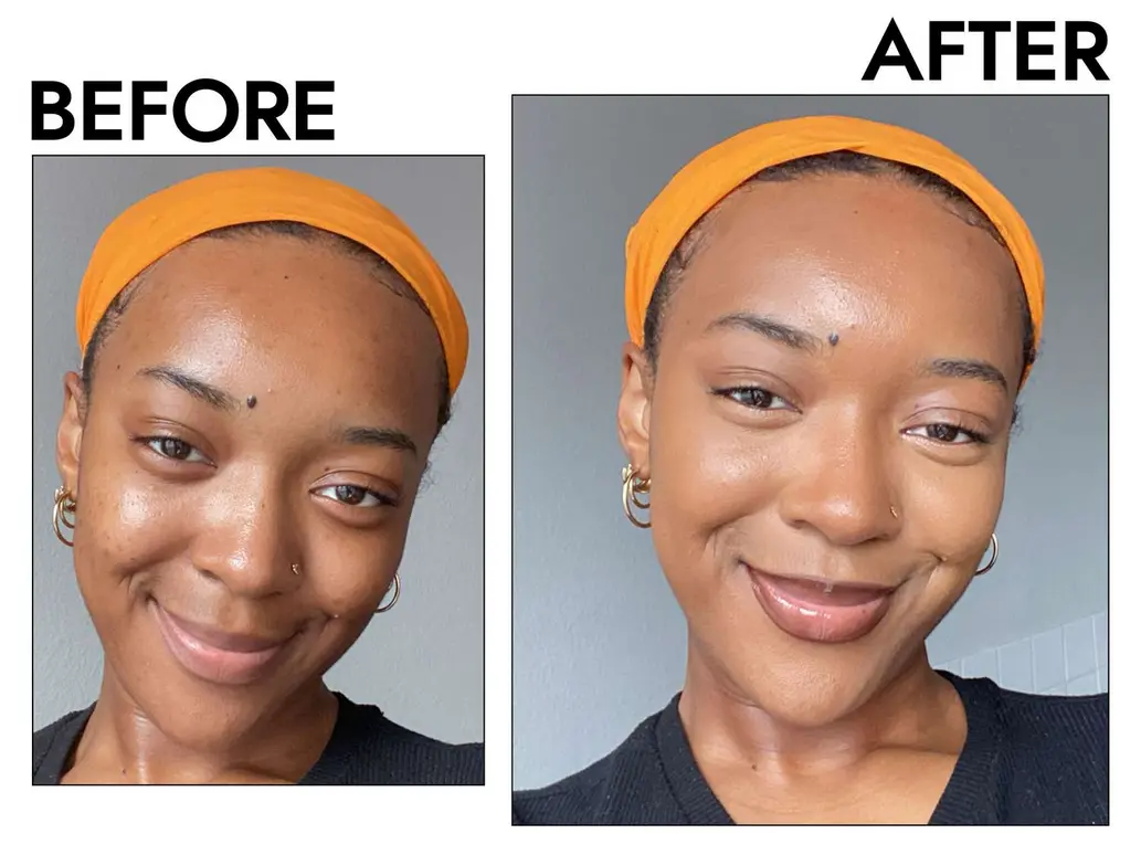 Face before and after using serums